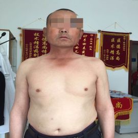治疗后