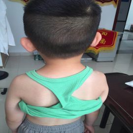 治疗后